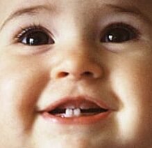 odontopediatria em porto alegre