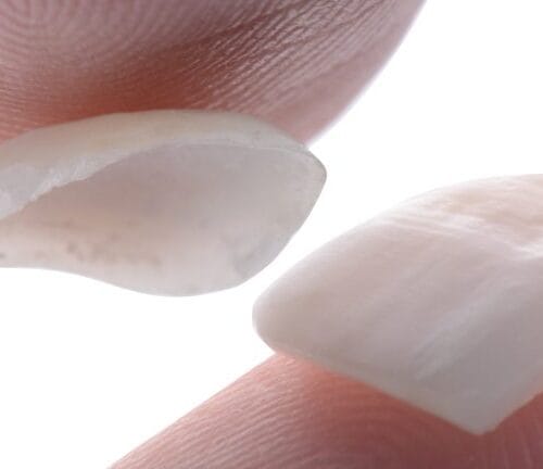 facetas.001-768x432-1-500x432 facetas.001-768x432-1-500x432