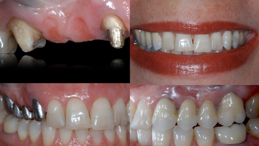 ponte-fixa.001-1024x576 ponte-fixa.001-1024x576