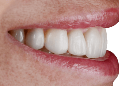 sorriso-editado sorriso-editado