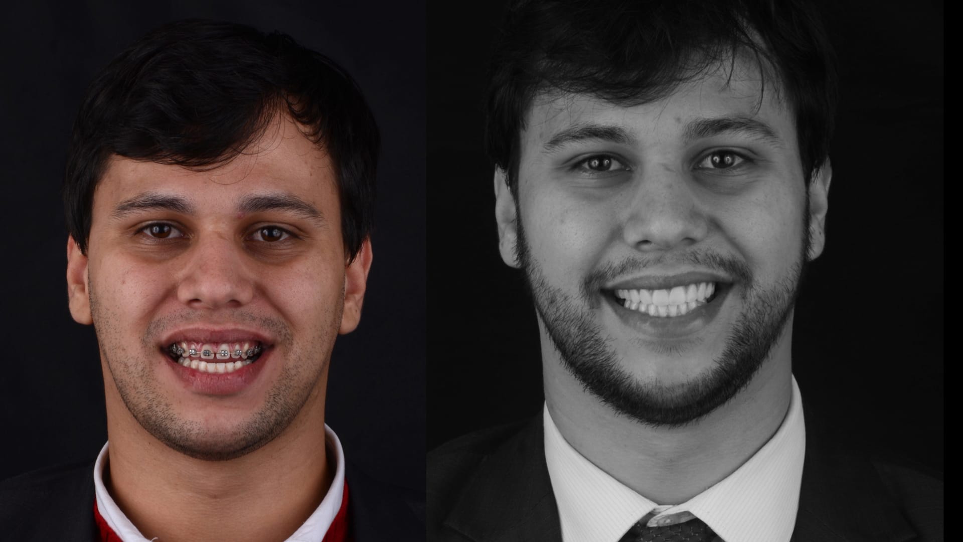 Antex x depois .013 Antex x depois .013