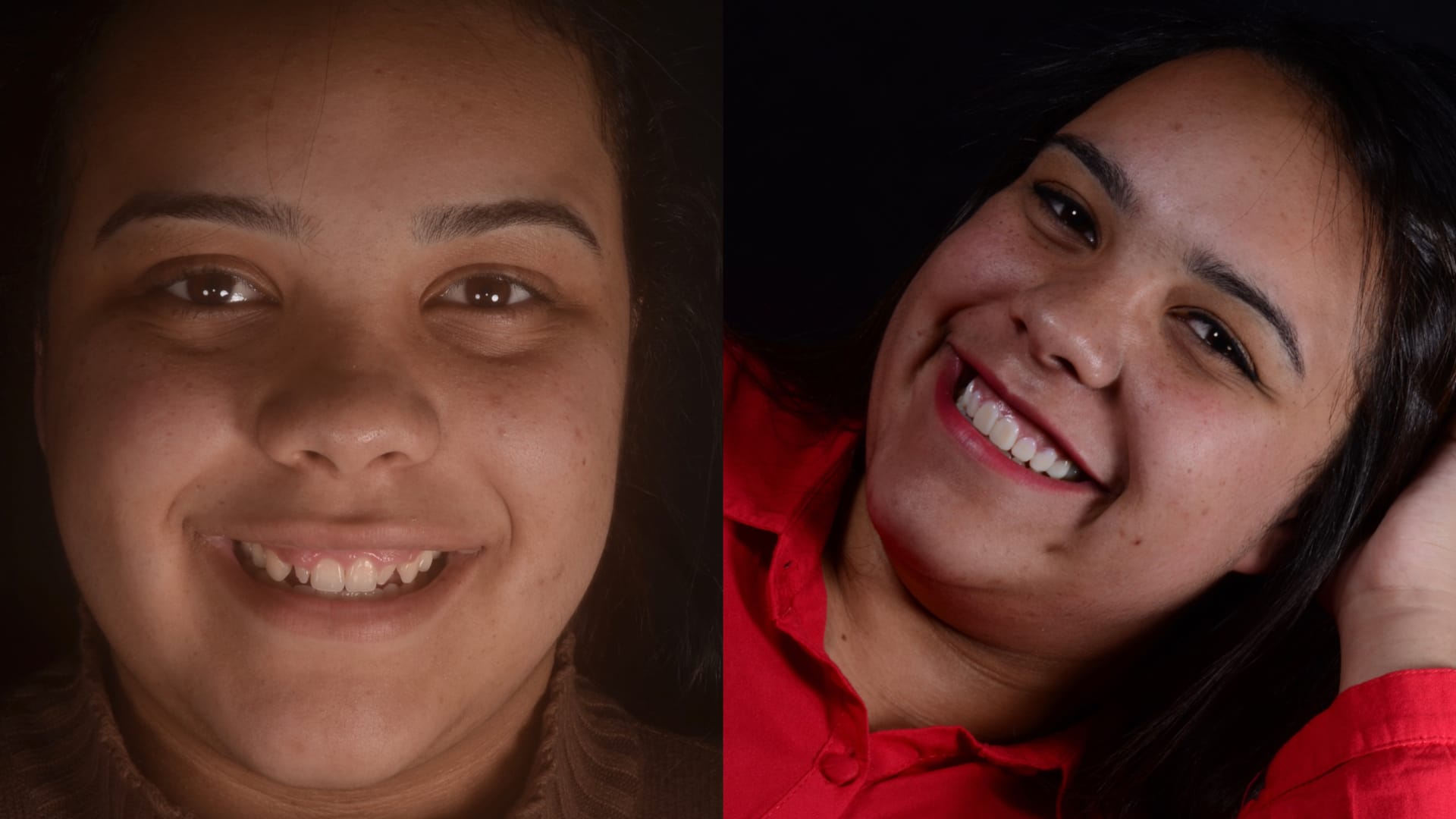 Antex x depois .020 Antex x depois .020