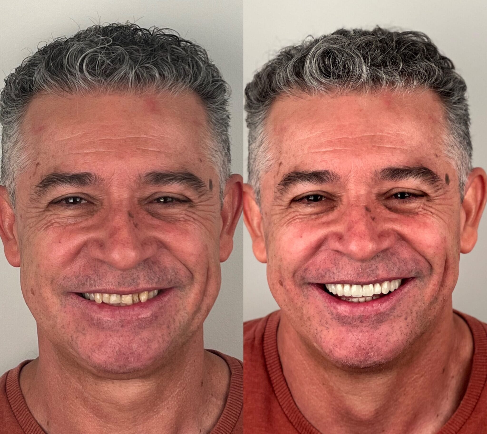 ISIMG-717352 ISIMG-717352