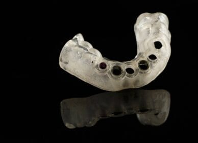 ImplantGuide-Parcial-1 ImplantGuide-Parcial-1