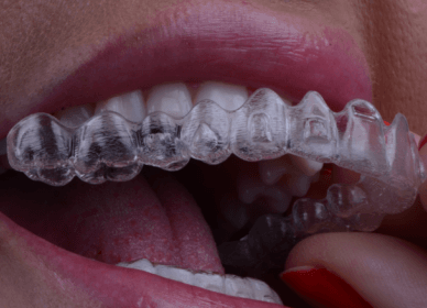 Reabilitação Oral e Ortodontia Dr. Rafael Pocztaruk Reabilitação Oral e Ortodontia Dr. Rafael Pocztaruk