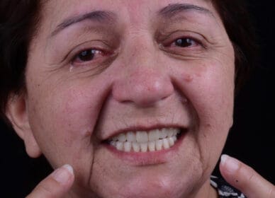 Workflow Digital em Implantodontia 2020.014