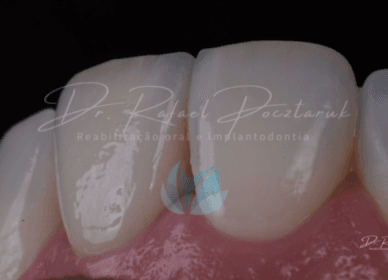 cirurgia guiada em porto alegre