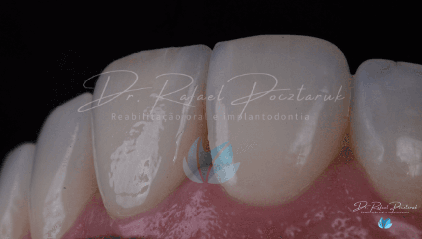 cirurgia guiada em porto alegre